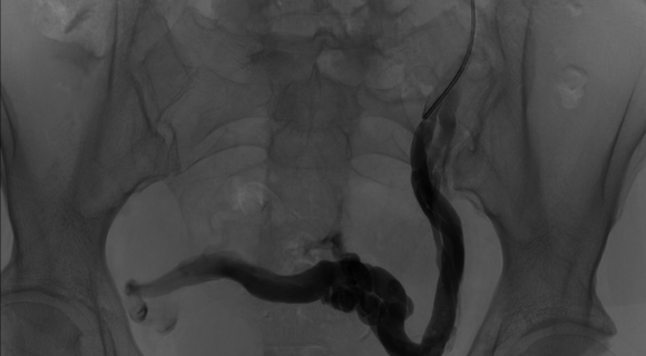 image radiologique