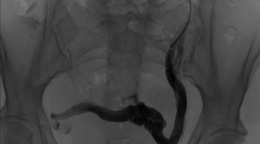 image radiologique