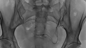 image radiologique